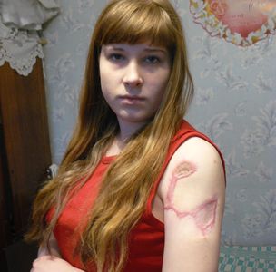История Илоны Гаух - 17-летней девушки из Чебаркуля - обошла многие СМИ