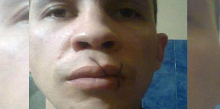 «Объявил голодовку». Челябинский осужденный зашил себе рот в знак протеста