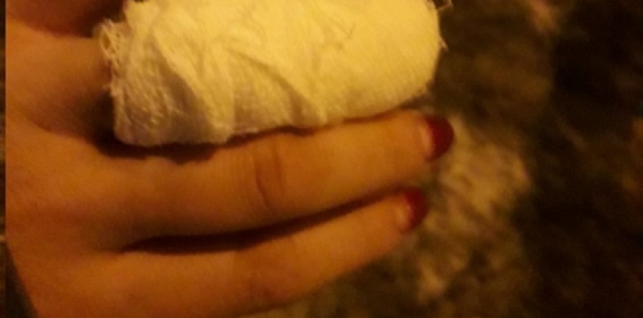 В драке женщина откусила и съела палец соседки в Челябинске (ФОТО)