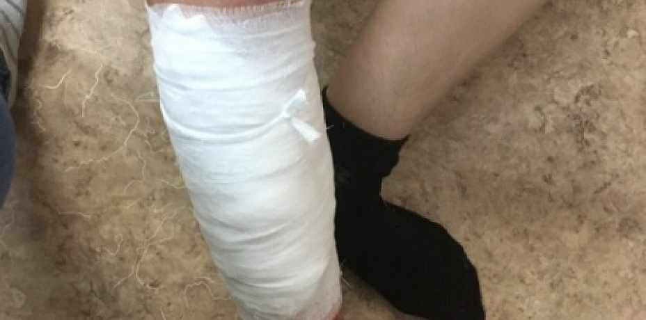 После прыжков на батуте получил 10 швов на ноге мальчик в Челябинске (ФОТО)