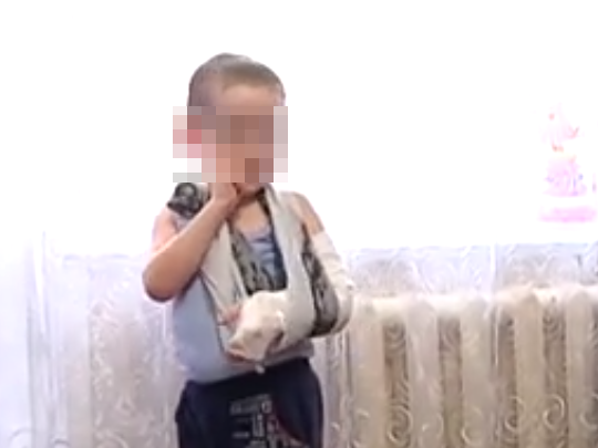 В Уфе 4-летний мальчик сломал руку в детсаду