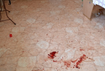 В Копейске парень ударил посетителя кафе ножом