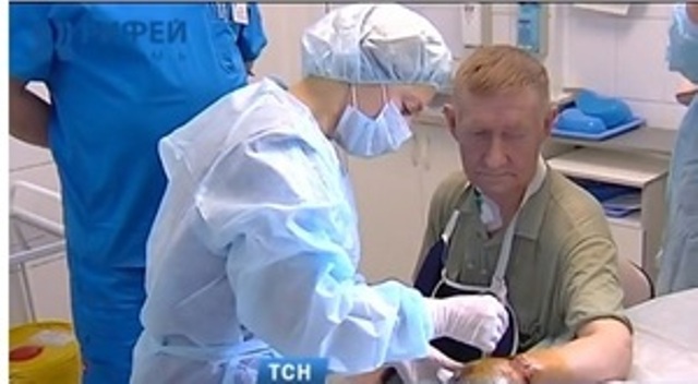 Отрубленную топором кисть пришили мужчине врачи в Перми (ФОТО)