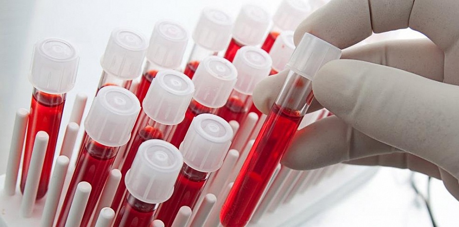 Ученые выяснили, чем болеют люди каждой группы крови